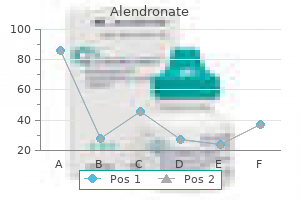 cheap alendronate 35mg free shipping