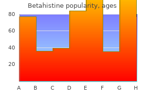 betahistine 16mg fast delivery