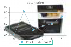 buy 16mg betahistine mastercard