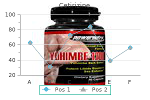 5mg cetirizine