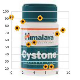 Central diabetes insipidus