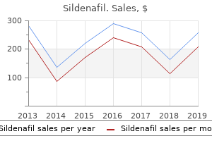 order 25 mg sildenafil