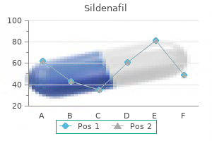 100mg sildenafil